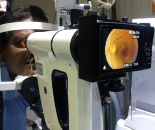 Fundus Camera